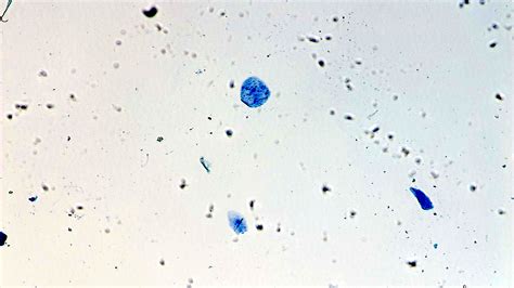 Cheek Cells Under Microscope Labeled