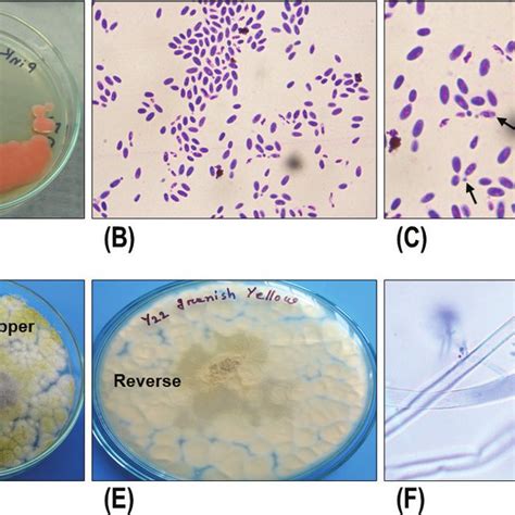 Cultural and morphological characteristics of fungi. (A) Growth of... | Download Scientific Diagram