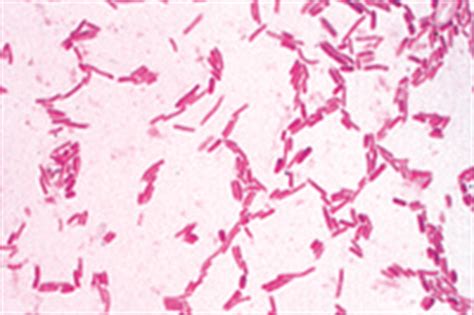 Salmonella Gram Stain - Stock Image Photomicrograph Of Salmonella Sp A Gram Negative Enteric Rod ...