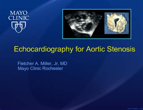 Echocardiography for Aortic Stenosis | tctmd.com