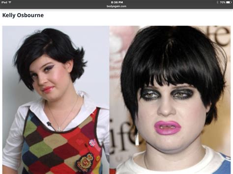 Kelly Osbourne Before And After Plastic Surgery