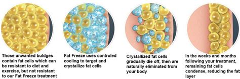 Freeze Your Fat | Spoiled Laser