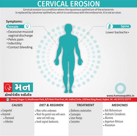 Cervical Erosion (Cervical Ectopy)