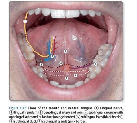 Sublingual Caruncle Swelling