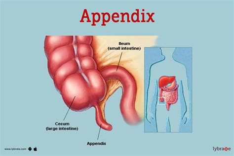 Appendix (Human Anatomy): Picture, Function, Diseases, Tests, and Treatments