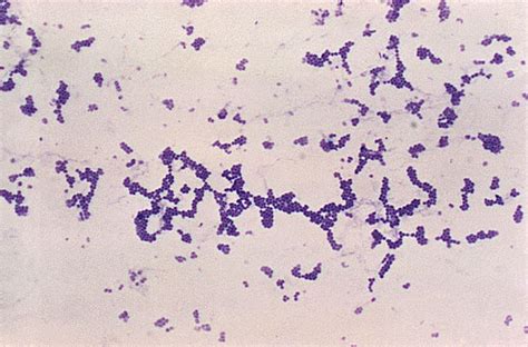 Gram Stain Procedure in Microbiology