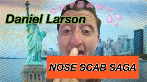 Daniel Larson Nose Scab Saga - YouTube