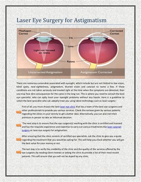 Laser eye surgery for astigmatism