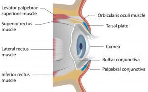 Raccoon eyes causes, racoon eye sign, diagnosis & treatment