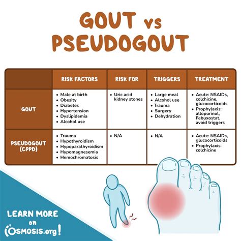 Gout Vs Pseudogout Crystals