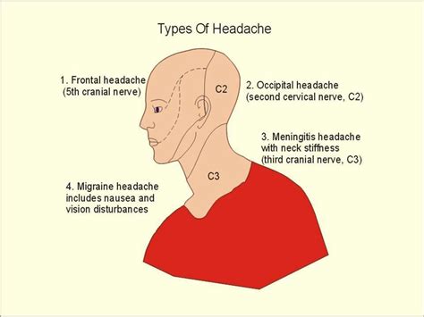 Pin by Ginger Jackson on Health&Exercises | Pinterest | Headache location, Health and Headache ...