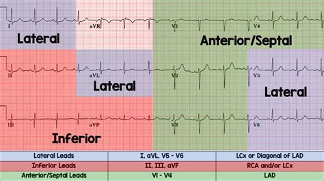 Coronary Anatomy ECG Leads REBEL EM Emergency Medicine Blog, 51% OFF