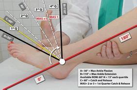 Spasticity assessment. Modified Ashworth scale.