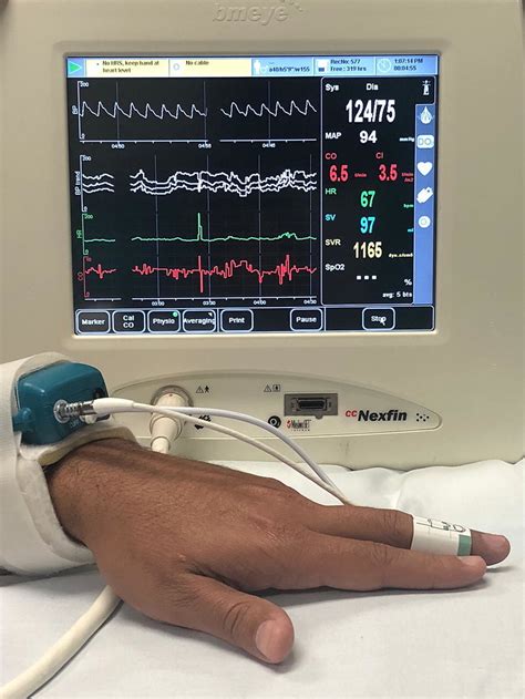 melocotón transatlántico Aburrido invasive hemodynamic monitoring ...