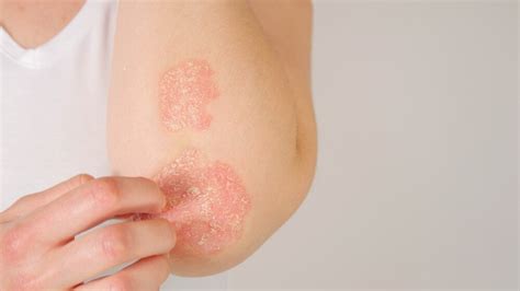 Skin Lesions: Spotting Red Flags | Advanced Surgical Physicians