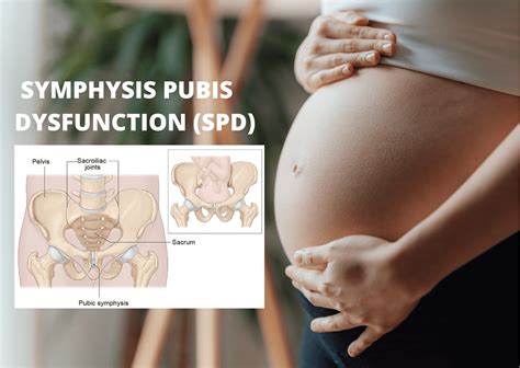 Symphysis Pubis Dysfunction (SPD) - Orchard Health Clinic - Osteopathy ...