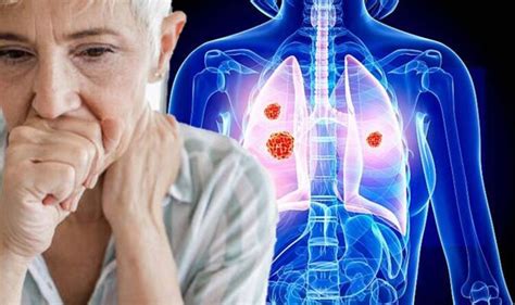 Lung cancer: Having a new continuous cough for longer than two weeks is a sign | Express.co.uk