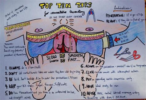 The Procedure of ED Thoracotomy