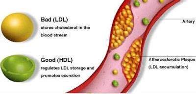 Blood Cholesterol: Management and General Information | Disabled World