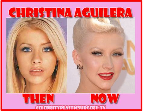 Christina Aguilera Plastic Surgery After and Before Nose Job, Botox ...