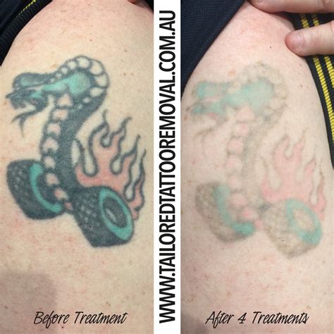 Does your old tattoo need a fresh new cover up? — Tailored Tattoo ...