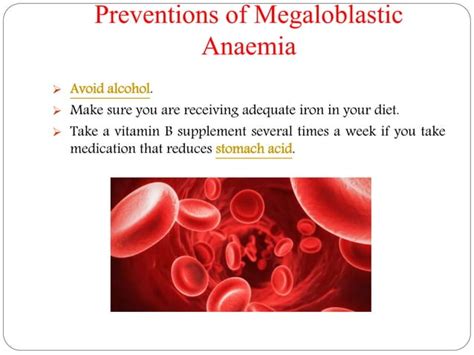 Megaloblastic Anaemia: Symptoms, causes, diagnosis, treatment and preventions. | PPT