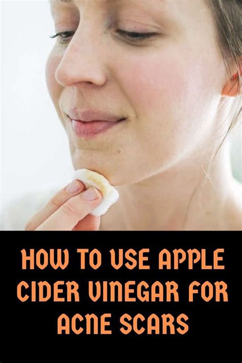 10 proven benefits of apple cider vinegar for health skin use – Artofit