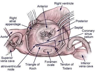 Tricuspid Valve Anatomy: Overview, Gross Anatomy, Microscopic Anatomy