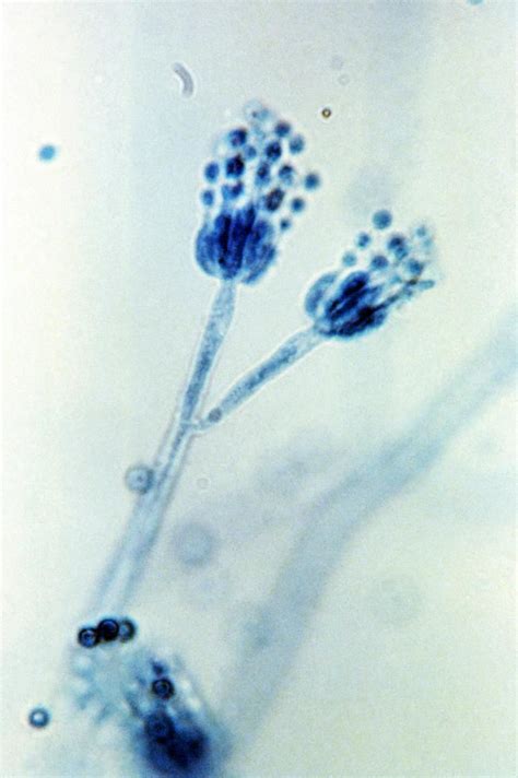 Penicillium marneffei - Alchetron, The Free Social Encyclopedia