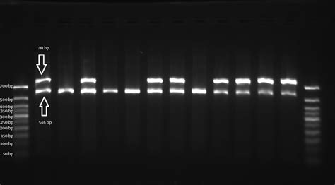 A Representation of the Products of ARMS-PCR of A1298C (rs1801131) of ...