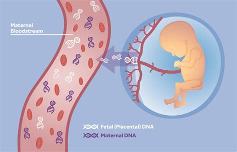 Non-Invasive Prenatal Testing (NIPT) - The SAFE Test - St George's University Hospitals NHS ...