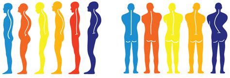 The Ultimate Guide To Posture Correction - Spine & Posture Care Sydney