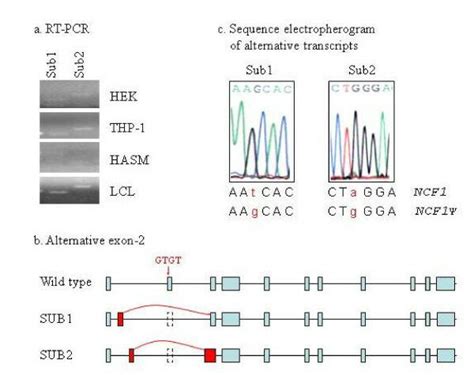 Alternative splicing of the NCF1 pseudogenes. a) RT-PCR detection of... | Download Scientific ...