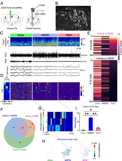 Deficiency of orexin signaling during sleep is involved in abnormal REM ...