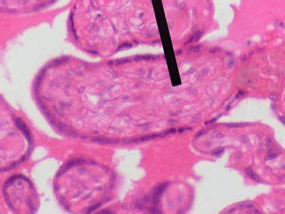 Connective Tissue Histology - Mesenchyme - histology slide