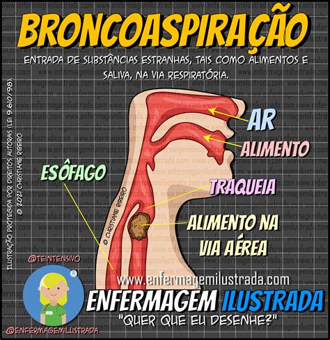 Broncoaspiração: O que é? - Enfermagem Ilustrada