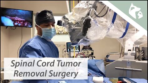 Spinal Cord Tumor Removal Surgery Vlog 14 - YouTube