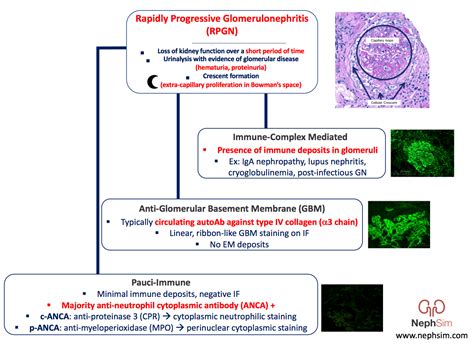 Types Of Glomerulonephritis