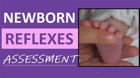 Newborn Reflexes Assessment (Infant) Nursing Pediatric NCLEX Review ...