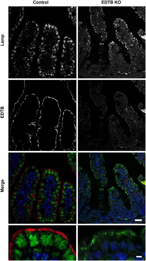 EDTB KO disrupts lysosomes. Immunofluorescent labeling of ileum using... | Download Scientific ...