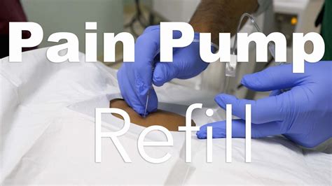 Behind The Scenes: Intrathecal Pain Pump Refill - YouTube