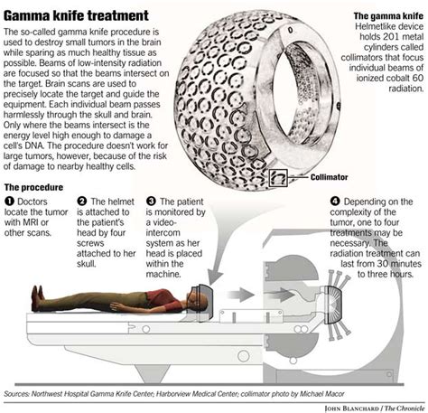 Gamma knife has great success against small brain tumors