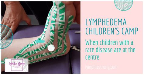 Lymphedema Children’s Camp – When children with a rare disease are at ...