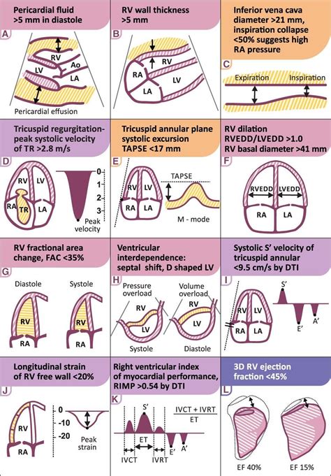 Pin by Lgray on Cardiology | Diagnostic medical sonography, Cardiology ...