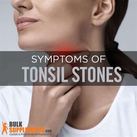 Tonsilloliths (Tonsil Stones): Risk Factors, Symptoms & Treatment