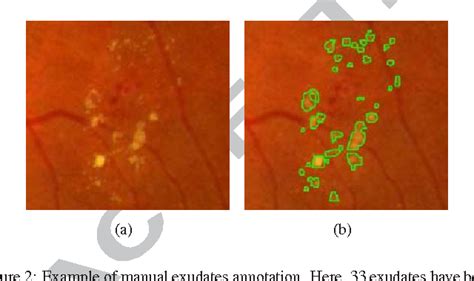 Structure of fundus of eye | Semantic Scholar