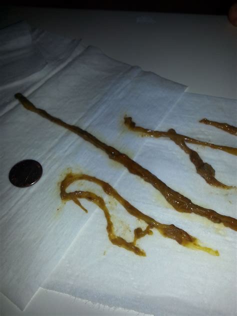 About Rope Worms - Rope Worms - What are They? | Natural healing remedies, Maintaining health ...