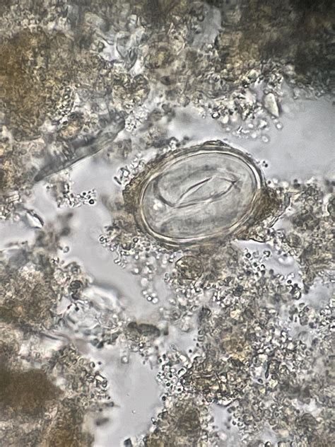 For your enjoyment: Physaloptera spp.eggs (canine/feline stomach worm)- source was an adult ...