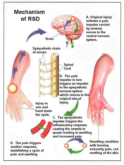 Clinical Practice Guidelines - RSD Foundation