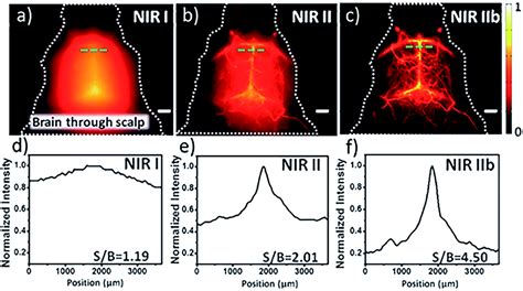 Near-infrared Zone II Fluorescence Imaging Technology and Its Prospects in Biomedical ...